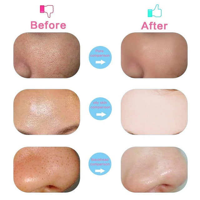 5 in 1 Facial Electric Cleanser
