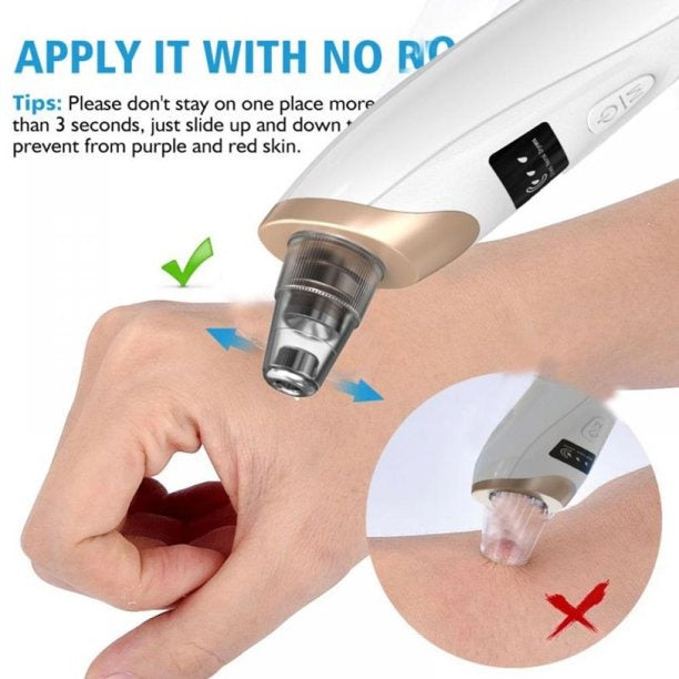 Electric Suction Blackhead