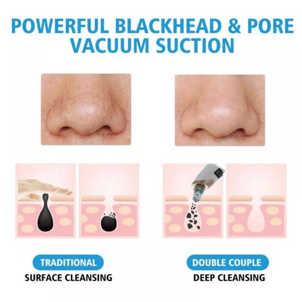 Electric Suction Blackhead